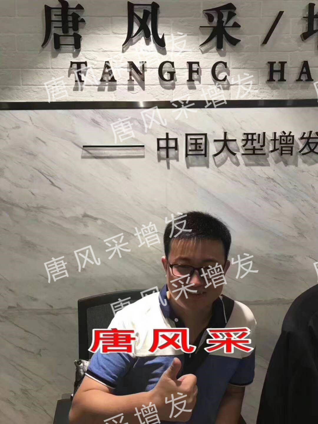 貧窮限制了想象，禿頂限制了造型？