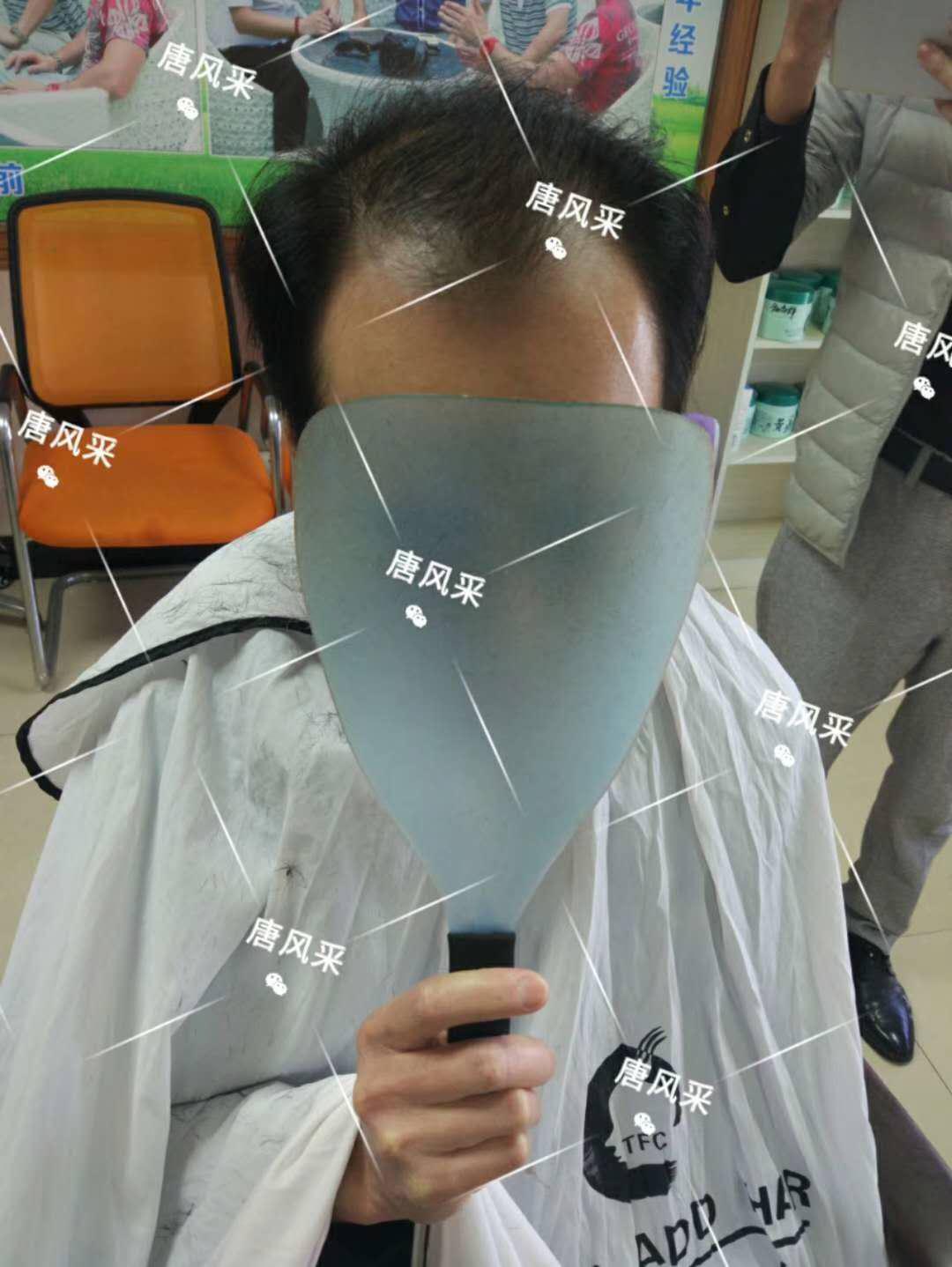 脫發(fā)謝頂壓力大，增發(fā)補(bǔ)發(fā)一身輕！