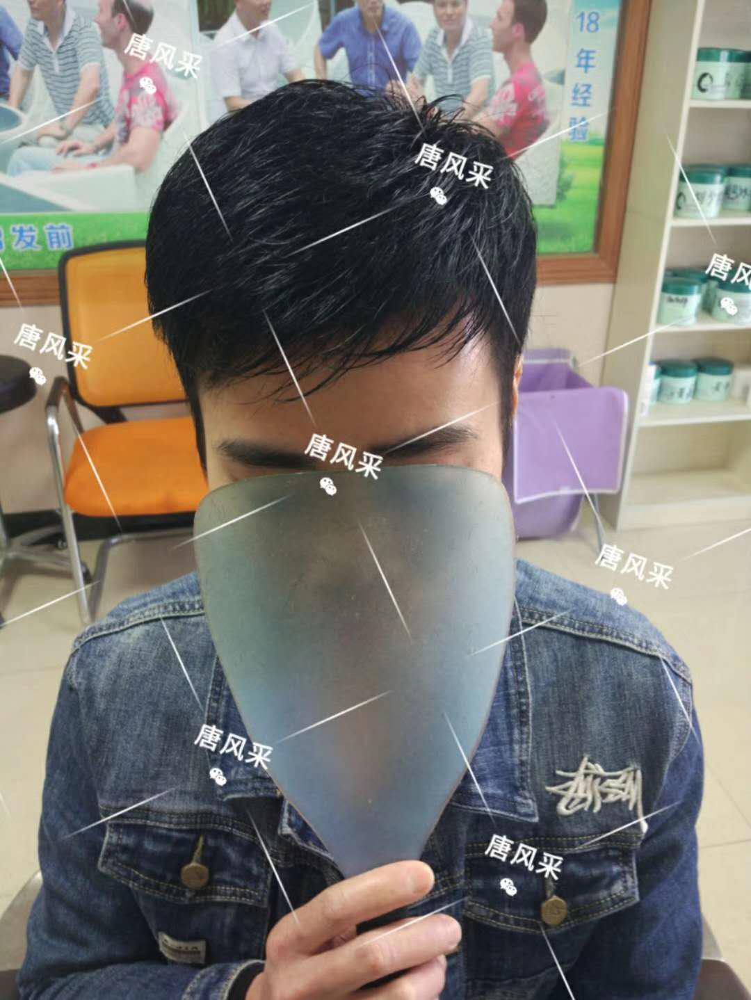 脫發(fā)謝頂壓力大，增發(fā)補(bǔ)發(fā)一身輕！