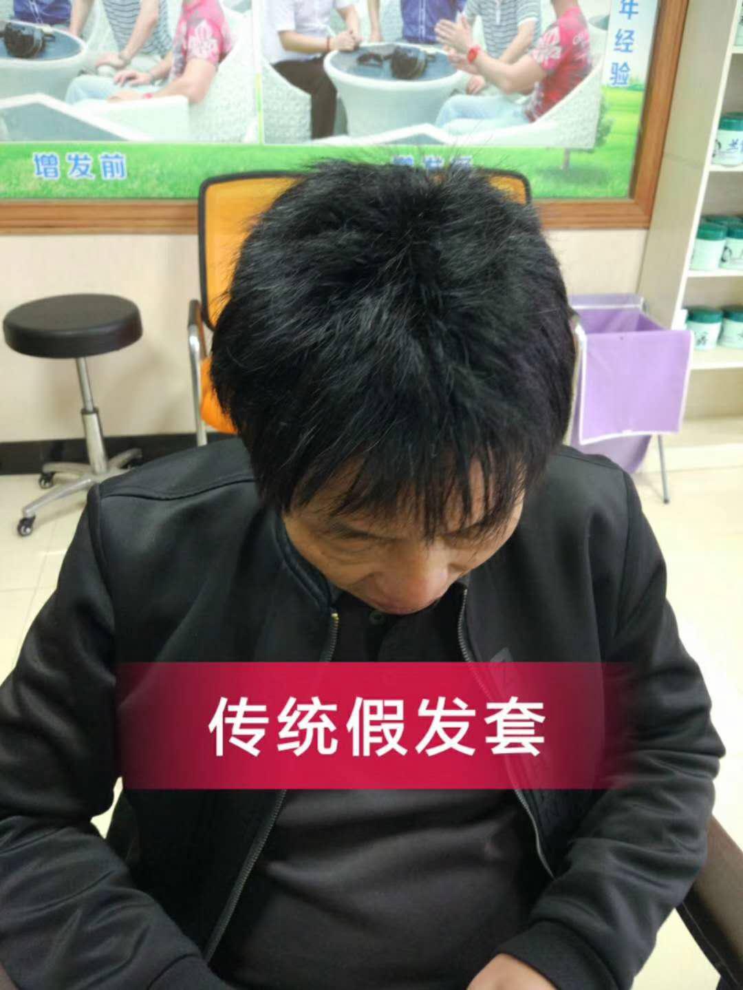 脫發(fā)謝頂壓力大，增發(fā)補(bǔ)發(fā)一身輕！