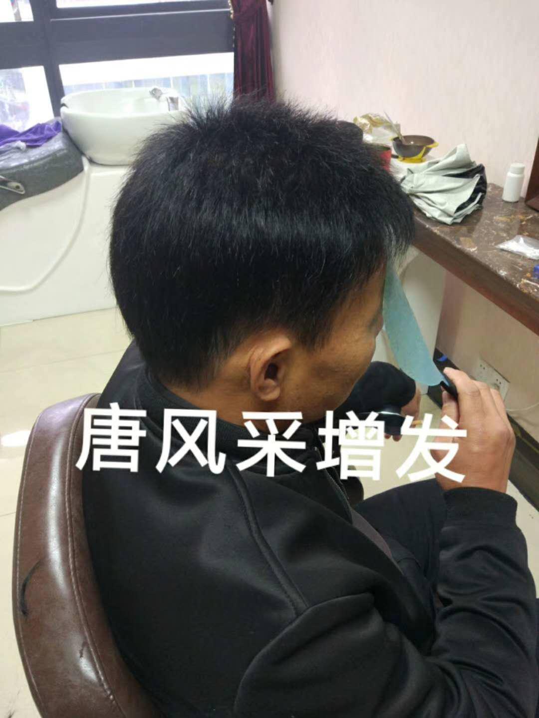 脫發(fā)謝頂壓力大，增發(fā)補(bǔ)發(fā)一身輕！