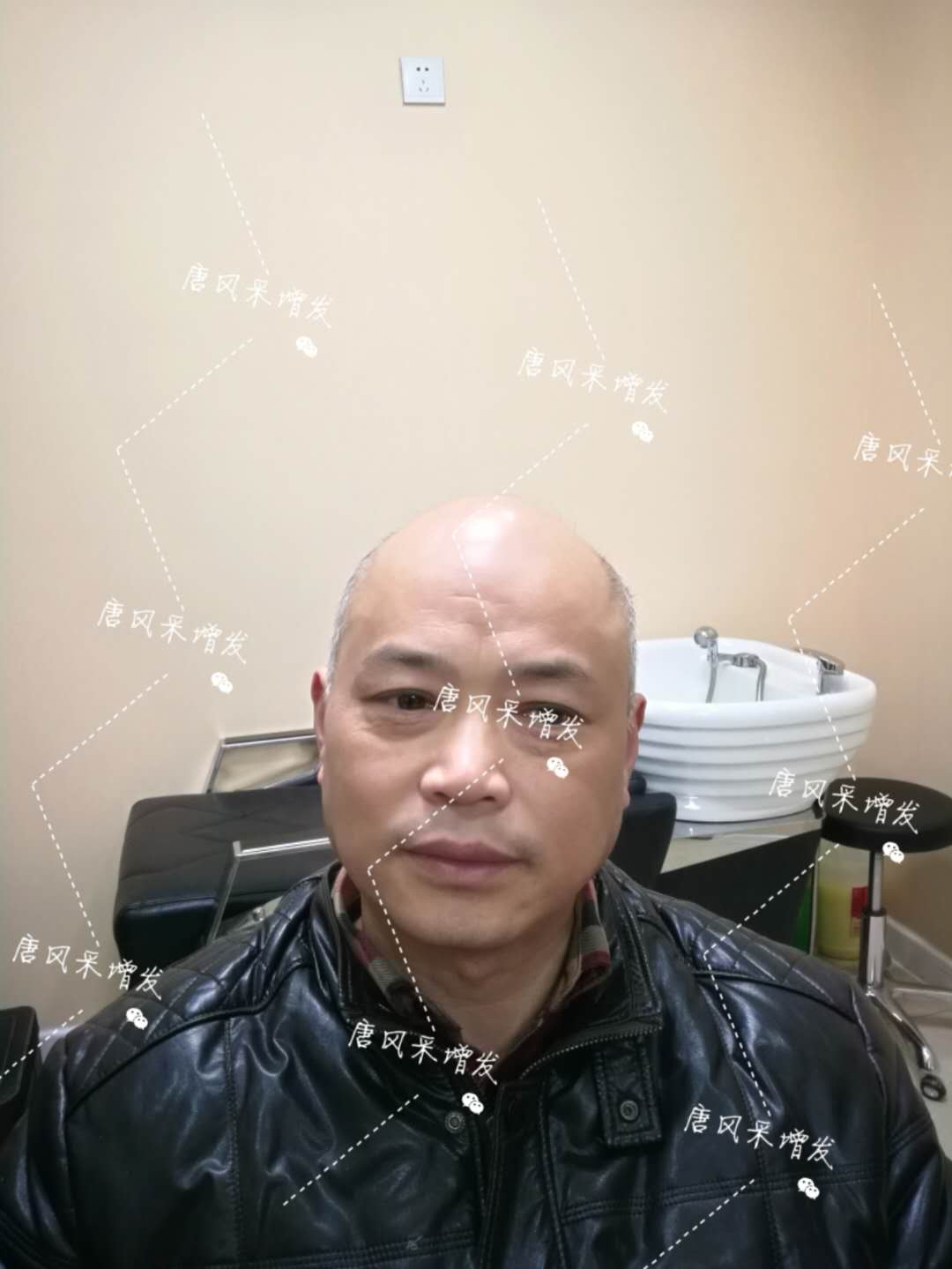 我的天吶！沒想到某防脫洗發(fā)水的老板居然也脫發(fā)了！