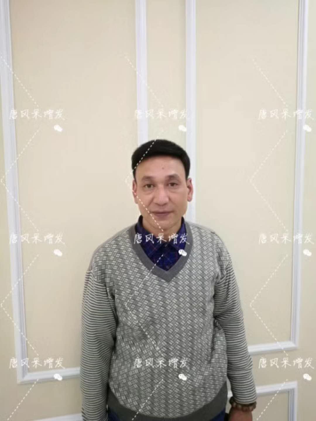 我的天吶！沒想到某防脫洗發(fā)水的老板居然也脫發(fā)了！