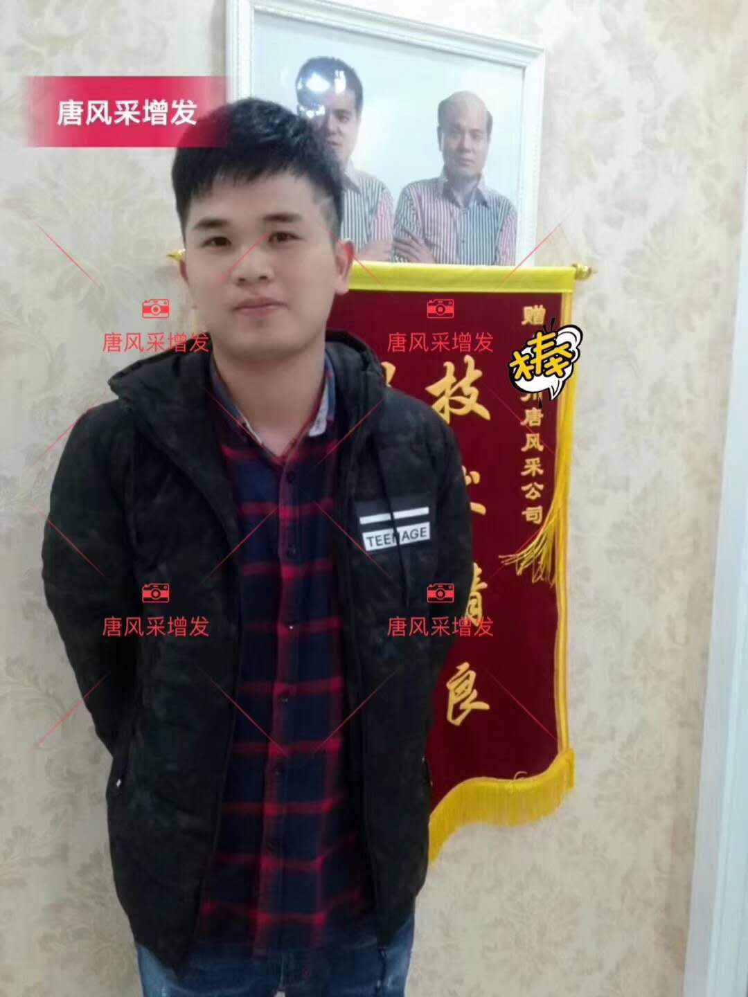為脫發(fā)者解千愁，增發(fā)前后的驚人對(duì)比！