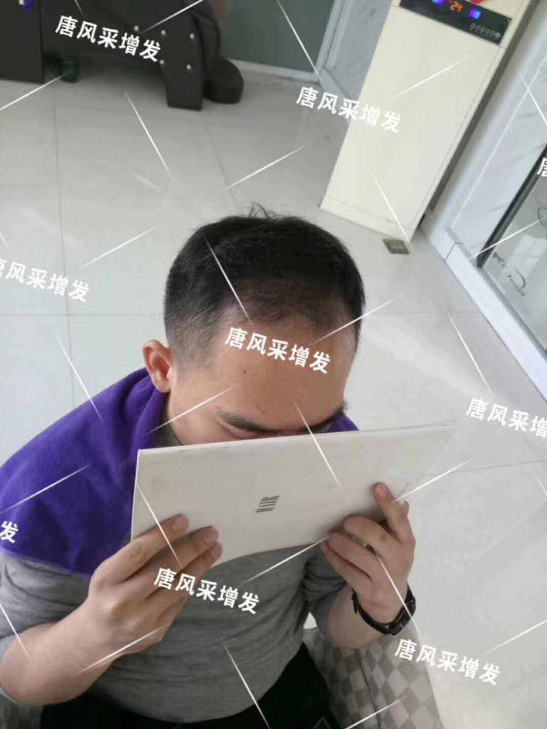 感覺(jué)自尊心好受打擊，朋友說(shuō)我“頭上的油都?jí)虺幢P(pán)菜了...