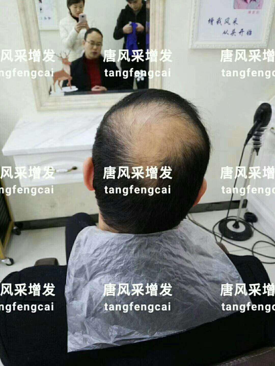  一轉(zhuǎn)眼年輕十歲，你差的就是這點點頭發(fā)！