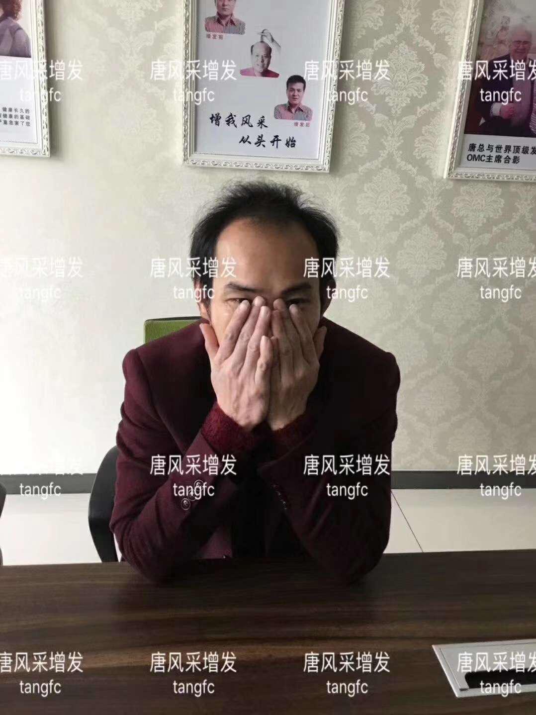 一轉(zhuǎn)眼年輕十歲，你差的就是這點點頭發(fā)！