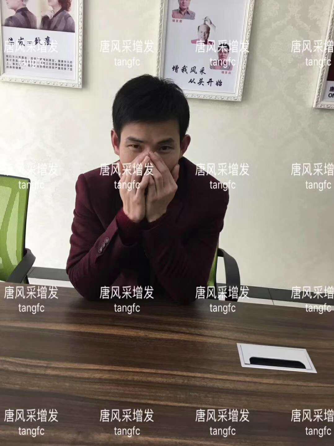  一轉(zhuǎn)眼年輕十歲，你差的就是這點點頭發(fā)！
