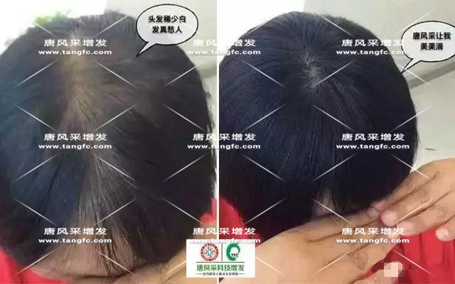 女士假發(fā)見證華麗轉(zhuǎn)變，前后差別震撼！