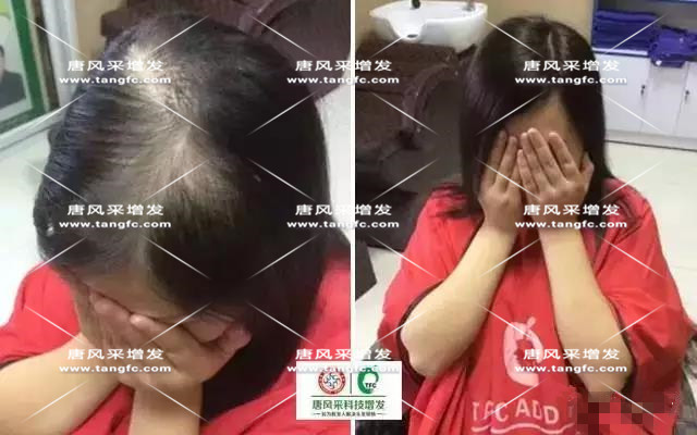 女士假發(fā)見證華麗轉(zhuǎn)變，前后差別震撼！