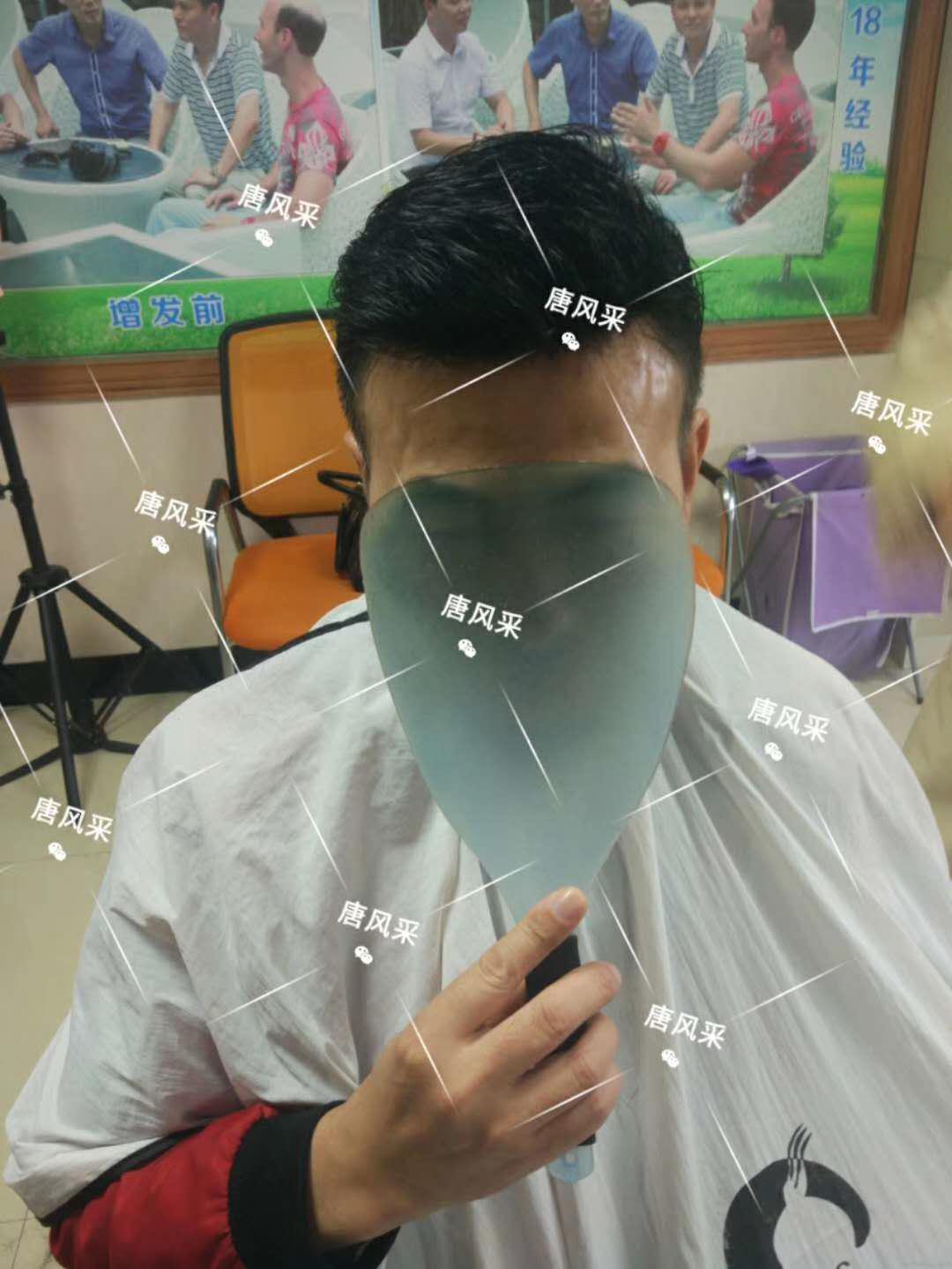 男人脫發(fā)原因多，不能一味怨腎虧！