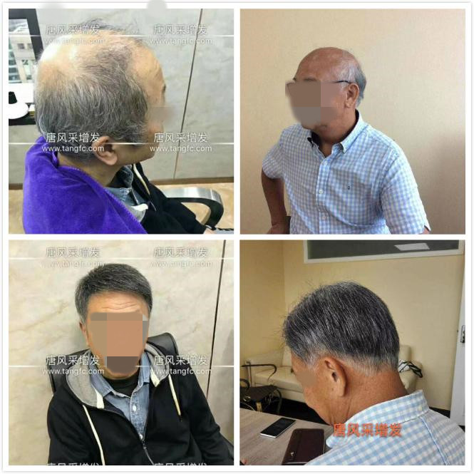 男老人假發(fā)超薄設(shè)計，這樣的逼真效果你絕對沒見過！