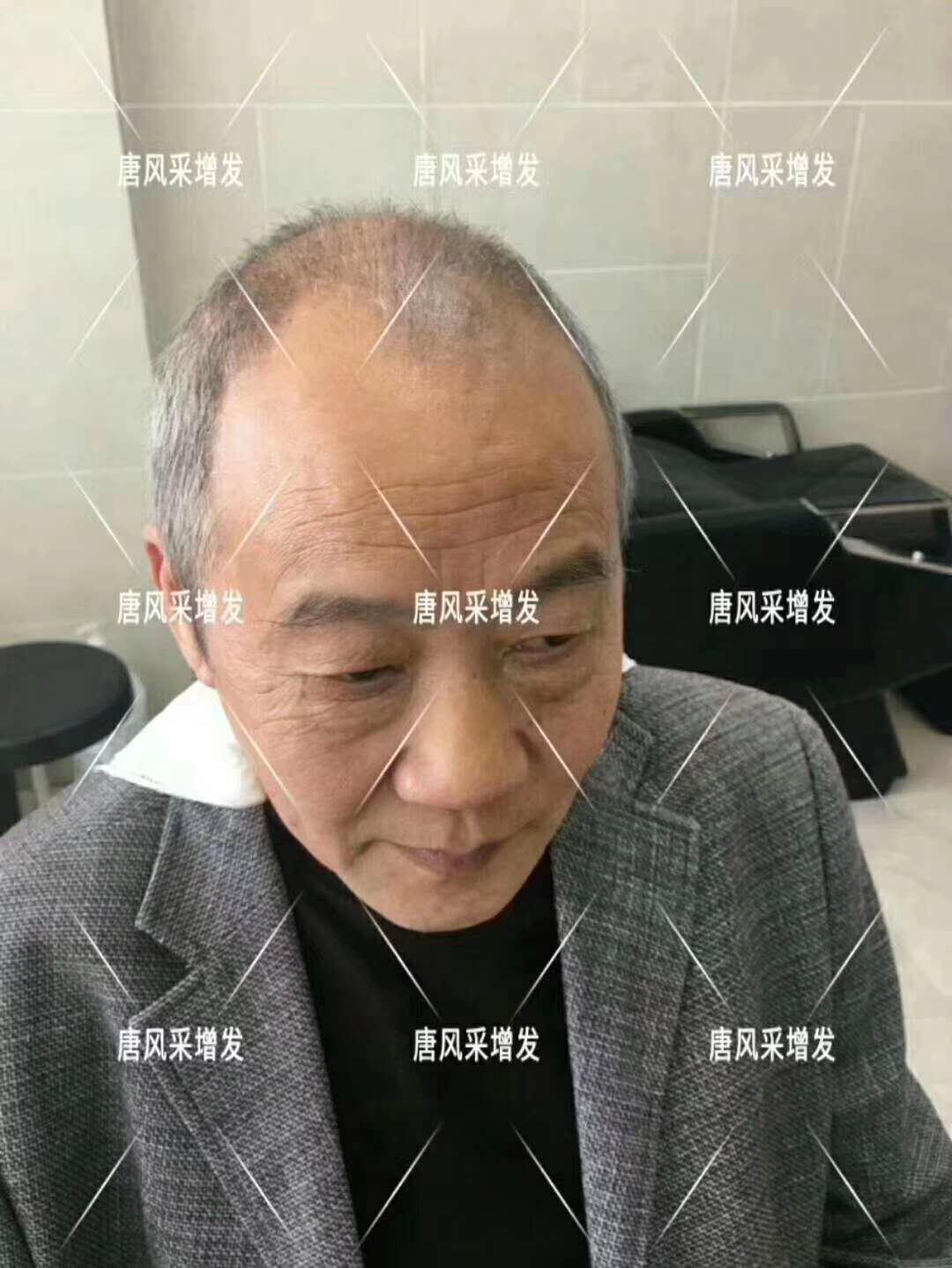 常按這個穴位好處多多 有助睡眠還能減少白頭發(fā)！
