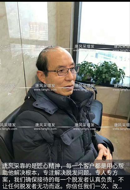 大爺大叔傻傻分不清楚？——唐風(fēng)采增發(fā)案例展示
