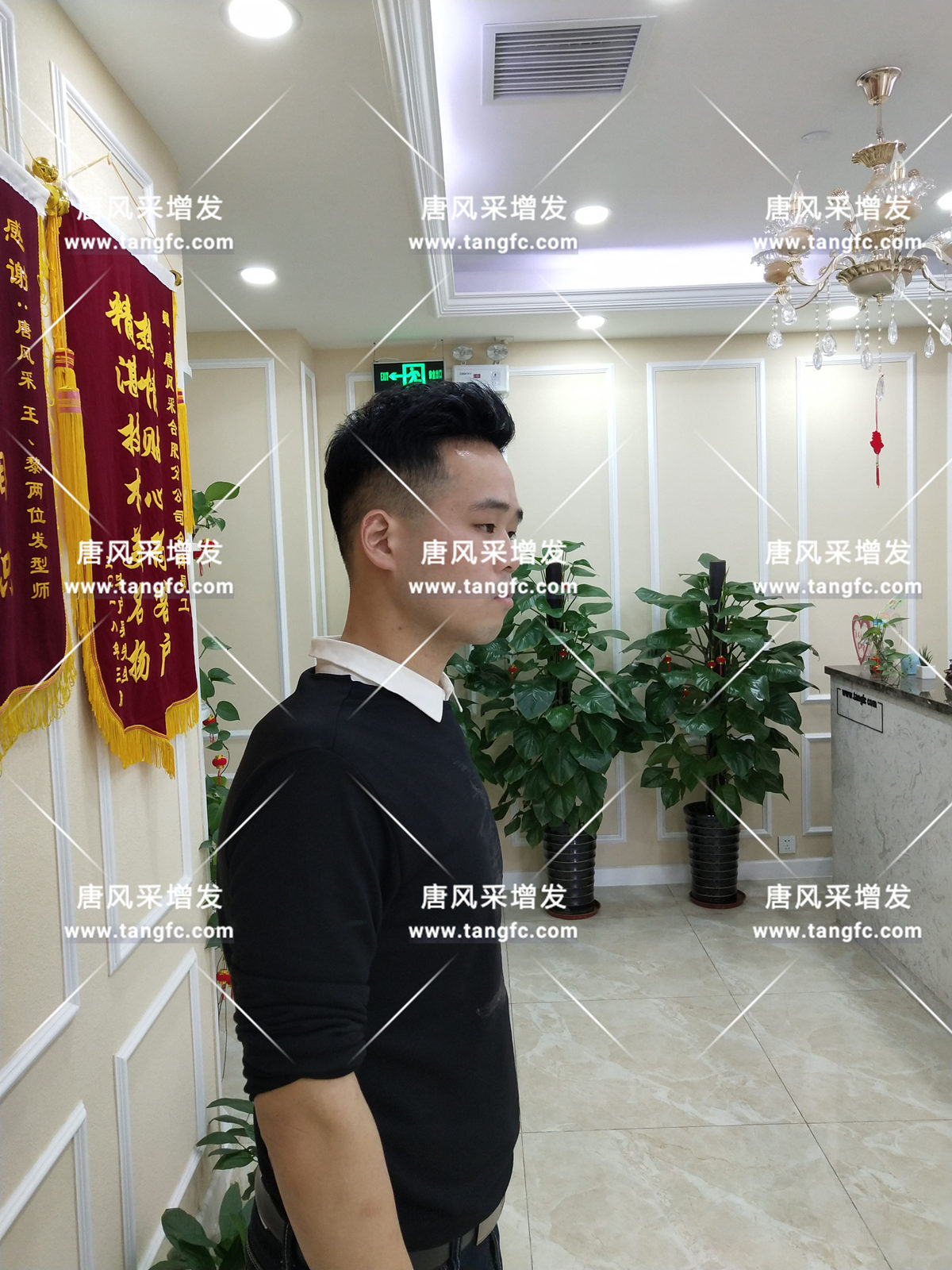 增發(fā)還是植發(fā)，這是個(gè)問(wèn)題！