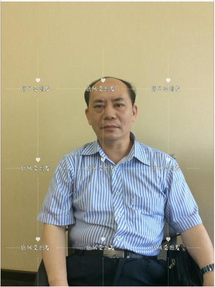存款重要還是頭發(fā)重要？聽(tīng)聽(tīng)李先生怎么說(shuō)！