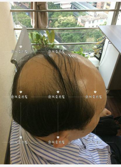 存款重要還是頭發(fā)重要？聽(tīng)聽(tīng)李先生怎么說(shuō)！