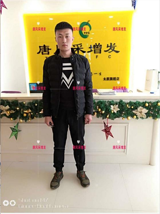 好形象擁抱新生活，唐風(fēng)采助力脫發(fā)新青年！