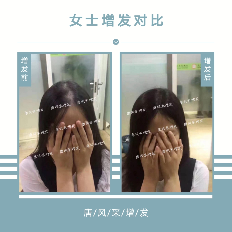 母親節(jié)：我能想到最美好的事，就是把媽媽的青春留??！