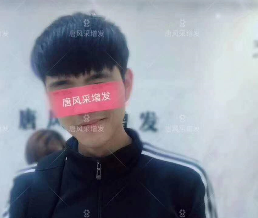 春夏季最新帥氣發(fā)型，頭發(fā)再少也能hold住！