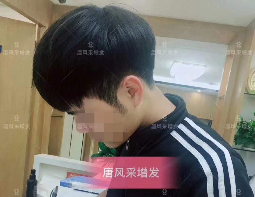 春夏季最新帥氣發(fā)型，頭發(fā)再少也能hold??！