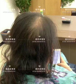 讓頭發(fā)一直好好的，唐風(fēng)采就是這般任性！