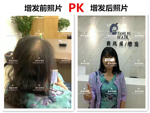 頭發(fā)稀少也能擁有一頭好發(fā)型，不信請(qǐng)看！