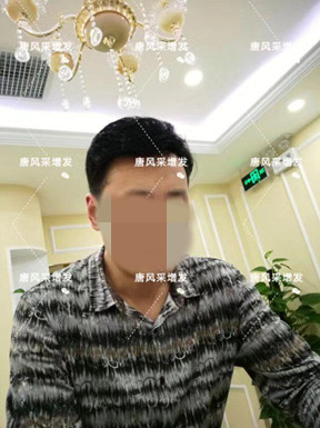 嘉興買(mǎi)隱形假發(fā)哪家好？很多人選擇嗎？