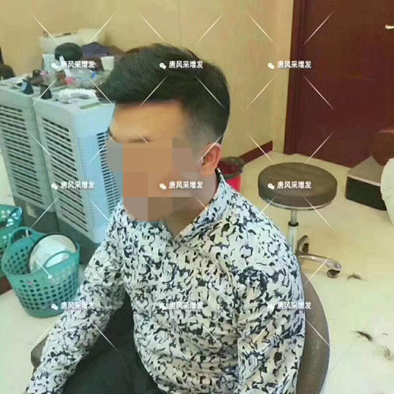 臺州真發(fā)假發(fā)哪有賣，夏天戴假發(fā)會悶熱嗎？