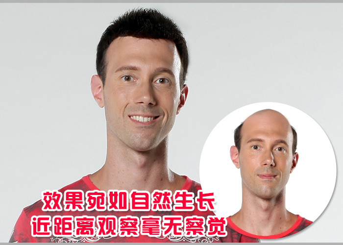 男士假發(fā)套價格貴嗎？買多少錢的效果看起來才逼真？
