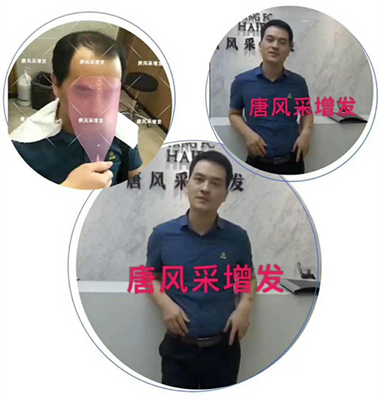 光禿禿的院子光禿禿的頭，與其羨慕不如改變！