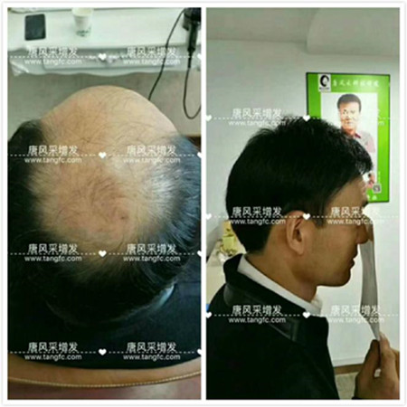 男款假發(fā)品牌哪家好，有用過唐風(fēng)采的嗎？