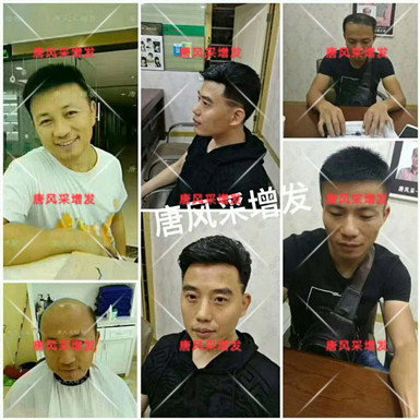男款假發(fā)品牌哪家好，有用過唐風(fēng)采的嗎？