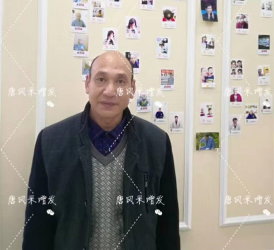 《我不是藥神》火了，山爭哥哥光頭變“藥神”成熱門話題！