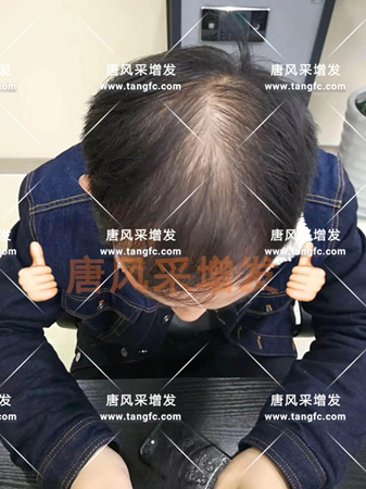 臺(tái)州哪里有賣(mài)假發(fā)的，逼真效果怎么樣？