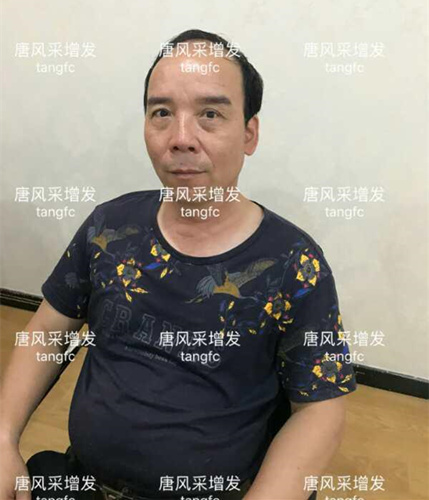 朋友碰面不敢認，直擊發(fā)友增發(fā)后的真實改變！