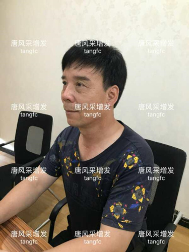朋友碰面不敢認，直擊發(fā)友增發(fā)后的真實改變！