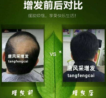 嘉興織發(fā)補發(fā)哪家好？發(fā)友們都“發(fā)”現(xiàn)了這家！