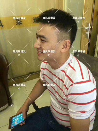 西寧織發(fā)補(bǔ)發(fā)哪家好，真的能改變我的脫發(fā)形象嗎？ 