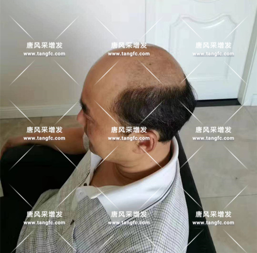 老年短假發(fā)全真發(fā)的好嗎？ 主要是用來(lái)遮白發(fā)的！