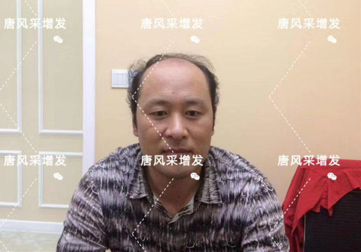 嘉興假發(fā)片定制哪家好？唐風采增發(fā)成了首選！
