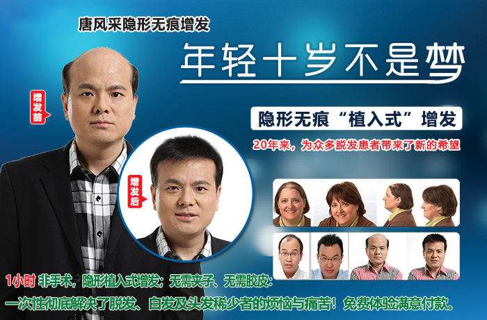 嘉興假發(fā)片定制哪家好？唐風采增發(fā)成了首選！