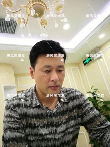 嘉興假發(fā)片定制哪家好？唐風采增發(fā)成了首選！