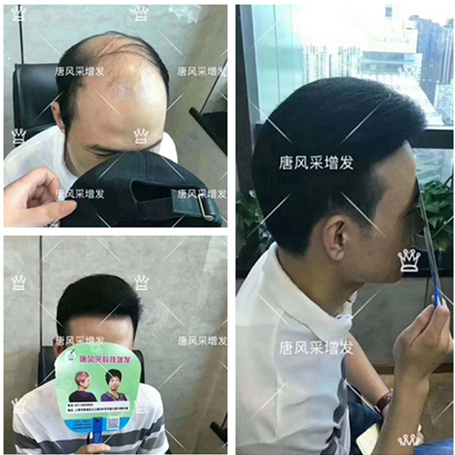 補發(fā)增發(fā)