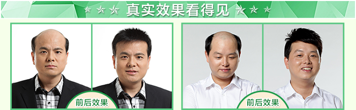 西寧哪里有假發(fā)專賣店 唐風采增發(fā)案例