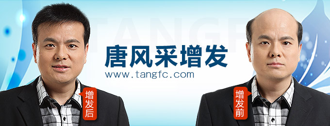 西寧哪里有假發(fā)專賣店 唐風采增發(fā)