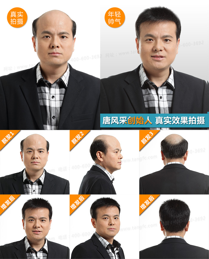 西寧哪里有賣假發(fā)的，什么品牌的假發(fā)性價(jià)比高呢？