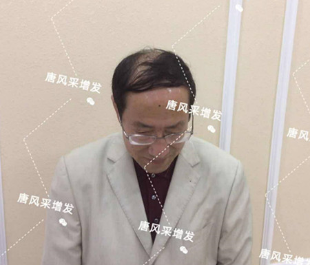 假發(fā)