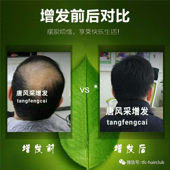 包頭哪里有真發(fā)假發(fā)套的專賣店？