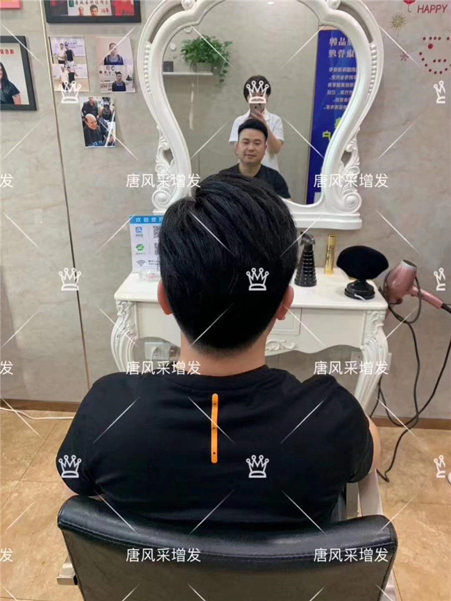 謝頂男人 在唐風采增發(fā)后